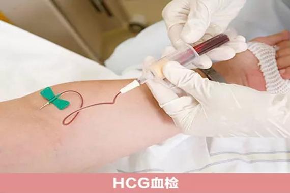 国内有正规的供卵试管代怀_国内正规供卵试管代怀中心